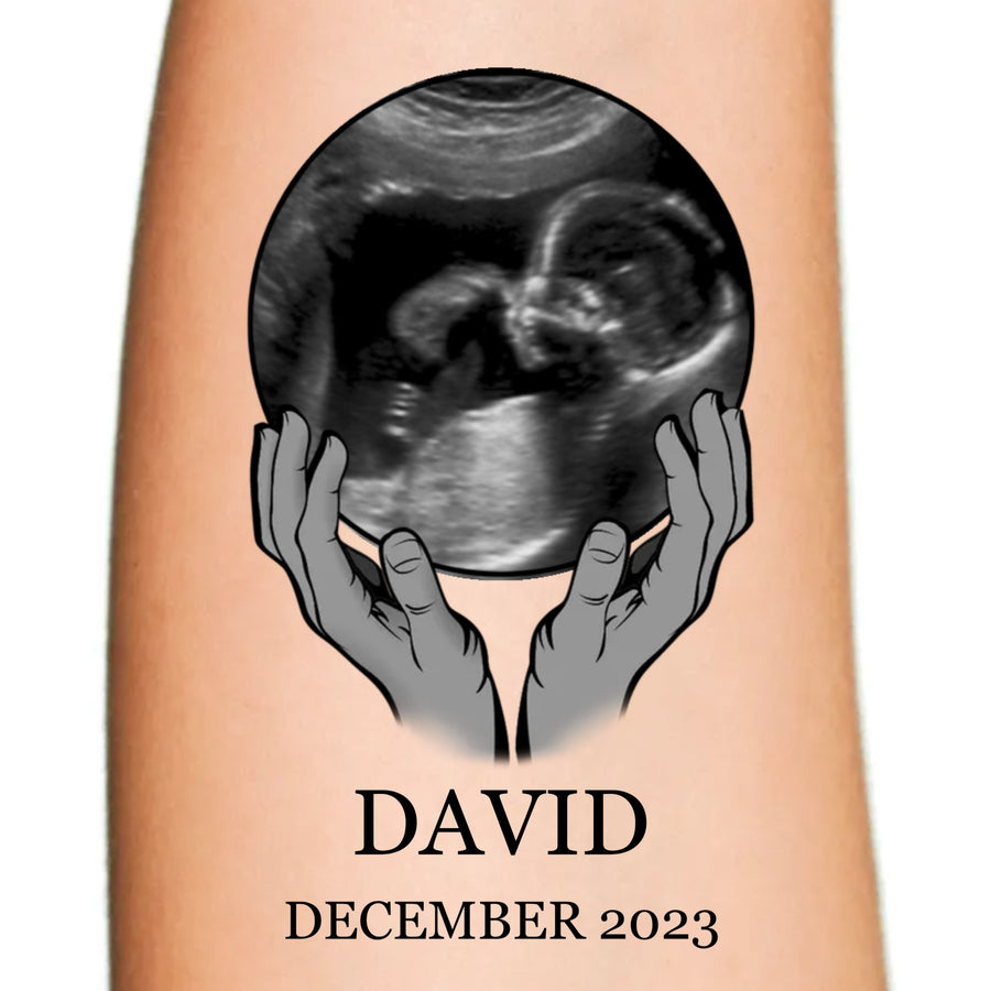 Ultrasound Round Frame