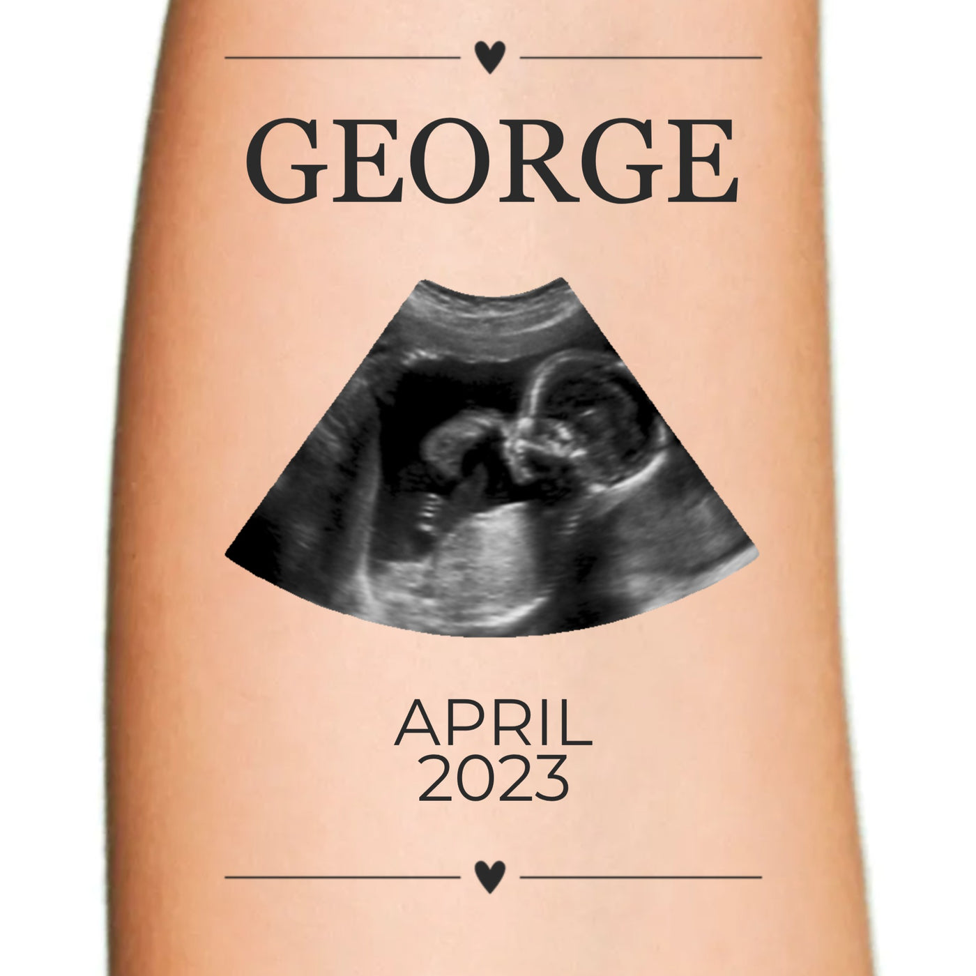 Ultrasound Photo