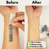 Premium Temporary Tattoo Removal Wipes